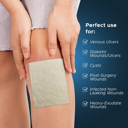 Silver Calcium Alginate Wound Dressing Pads – Antimicrobial, Sterile