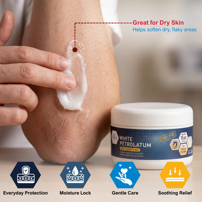 100% Pure White Petroleum Jelly – 15 oz Jar
