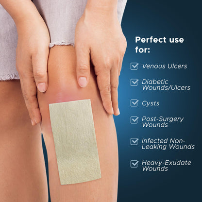Silver Calcium Alginate Wound Dressing Pads – Antimicrobial, Sterile