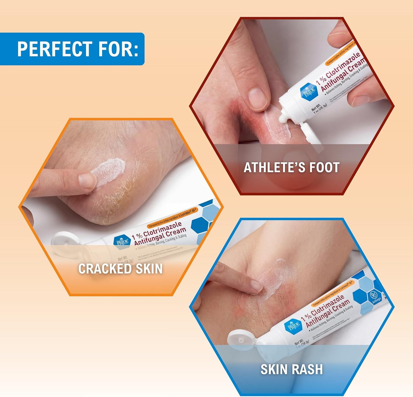 1% Clotrimazole Antifungal Cream – 1 oz Tube