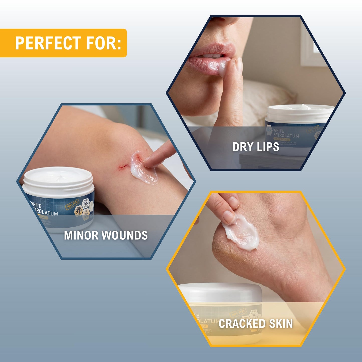 100% Pure White Petroleum Jelly – 15 oz Jar