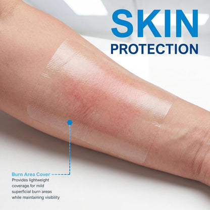 Transparent Film Wound Dressing – Sterile Adhesive Bandage