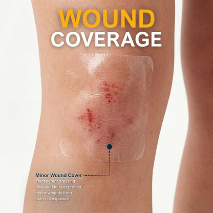 Transparent Film Wound Dressing – Sterile Adhesive Bandage