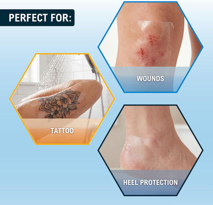 Transparent Film Wound Dressing – Sterile Adhesive Bandage