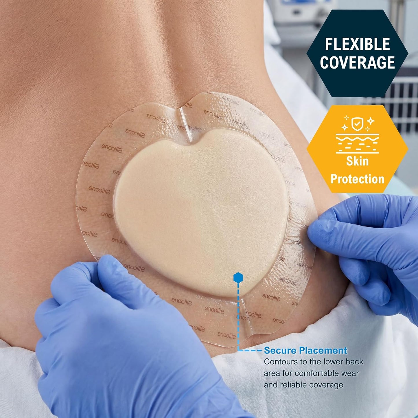 Sterile Sacral Silicone Foam Dressing – Waterproof Adhesive Border