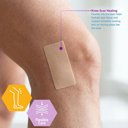 Silicone Scar & Wound Tape Roll – Waterproof, 1.5" × 1.6 yd